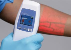 AccuVein equipment illuminates veins